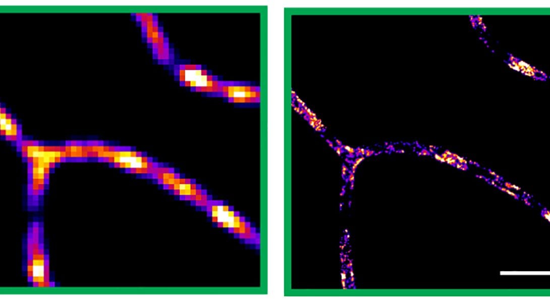 The Hu Group has found that dentritic cells form a long network to root out antigens.